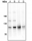 Anti-PKC mu (pS205) Antibody