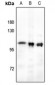 Anti-RB1 (pT821) Antibody