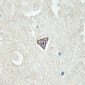Anti-L1CAM (pS1181) Antibody