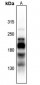 Anti-L1CAM (pS1181) Antibody