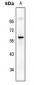 Anti-CD226 (pS329) Antibody