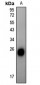 Anti-Alpha-crystallin B (pS59) Antibody