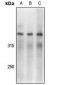 Anti-DNA-PKcs (pS2056) Antibody