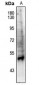 Anti-PPAR alpha (pS21) Antibody