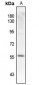 Anti-SMAD2 (pT220) Antibody
