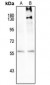 Anti-SMAD3 (pS208) Antibody