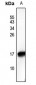 Anti-HMGN2 (pS29) Antibody