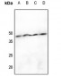 Anti-hnRNP D0 (pS83) Antibody