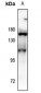 Anti-Aconitase 1 (pS138) Antibody
