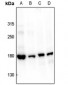 Anti-Topoisomerase 2 alpha (pS1106) Antibody