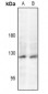 Anti-JAK2 (pY221) Antibody