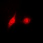 Anti-ERK1/2 (pY204) Antibody
