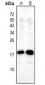 Anti-Alpha-synuclein (pY136) Antibody