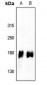 Anti-EGFR (pY1110) Antibody