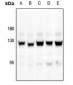 Anti-Focal Adhesion Kinase (pS843) Antibody