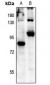 Anti-FOXO3 (pS315) Antibody