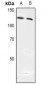 Anti-USP28 (pS714) Antibody