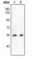 Anti-ETS1 (pS282) Antibody