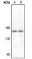 Anti-TIE2 Antibody