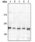 Anti-TSC2 Antibody