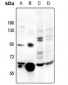 Anti-Catalase Antibody