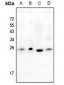 Anti-Alpha-crystallin B Antibody