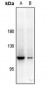 Anti-PYK2 Antibody