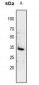 Anti-14-3-3 sigma Antibody