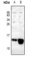 Anti-COX6C Antibody