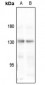 Anti-Collagen 4 alpha 3 Antibody