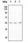 Anti-RAD23A Antibody