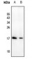 Anti-ATP5D Antibody