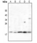 Anti-RCL Antibody