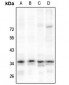 Anti-NKX2-4 Antibody