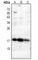 Anti-MGST1 Antibody