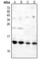 Anti-NDUFS6 Antibody