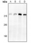 Anti-Cav3.2 Antibody