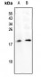 Anti-SUMO2 Antibody