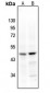 Anti-Factor VII Antibody