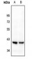 Anti-Kappa Opioid Receptor Antibody