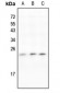 Anti-IL-11 Antibody