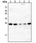 Anti-IL-20 Antibody