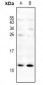 Anti-CXCL3 Antibody