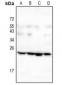 Anti-Leptin Antibody