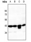 Anti-PAI1 Antibody