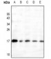 Anti-RAMP3 Antibody