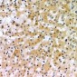 Anti-CD166 Antibody