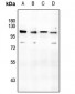 Anti-CD166 Antibody