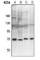 Anti-ZAP70 (pY292) Antibody