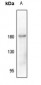Anti-CD115 (pY723) Antibody